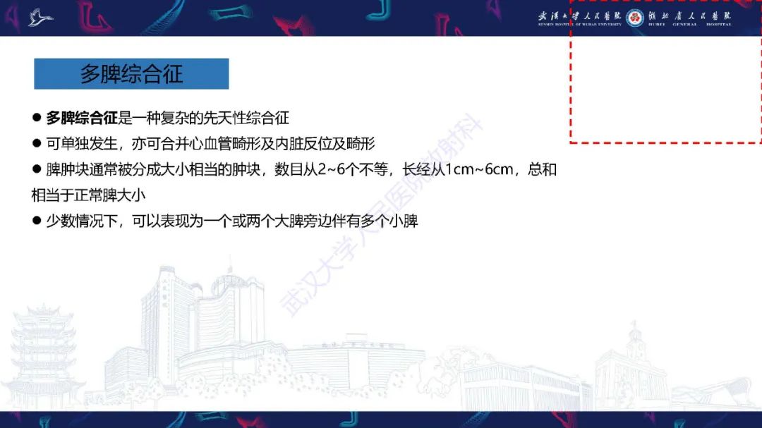 影像PPT - 【PPT】先天性脾脏异常影像诊断-21