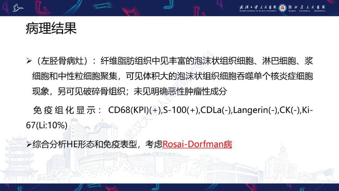 影像PPT - 【PPT】Rosai-Dorfman病影像诊断-6