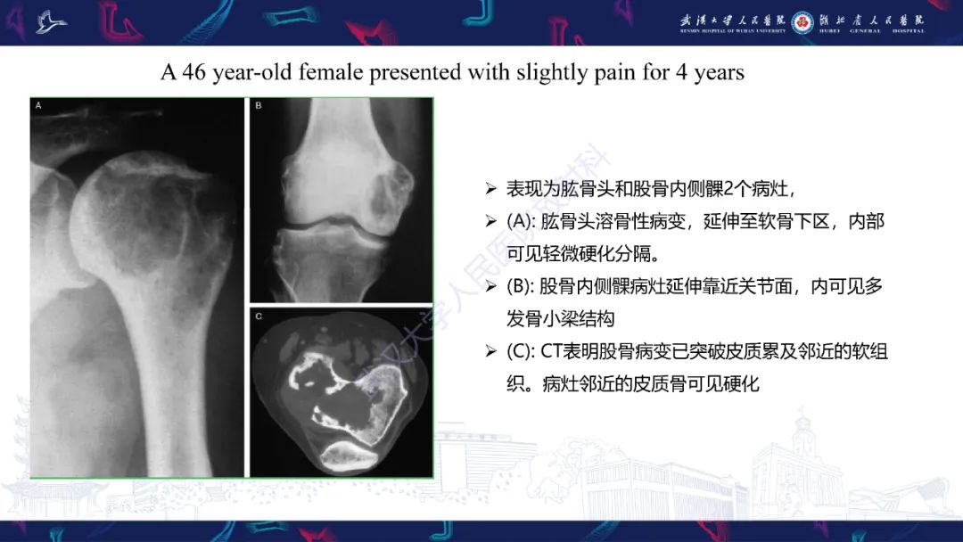影像PPT - 【PPT】Rosai-Dorfman病影像诊断-17