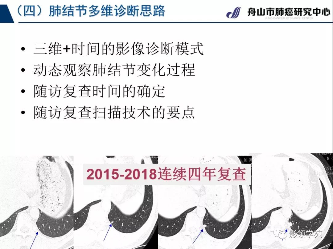 影像PPT - 【PPT】肺良恶性结节CT征象及鉴别诊断-23