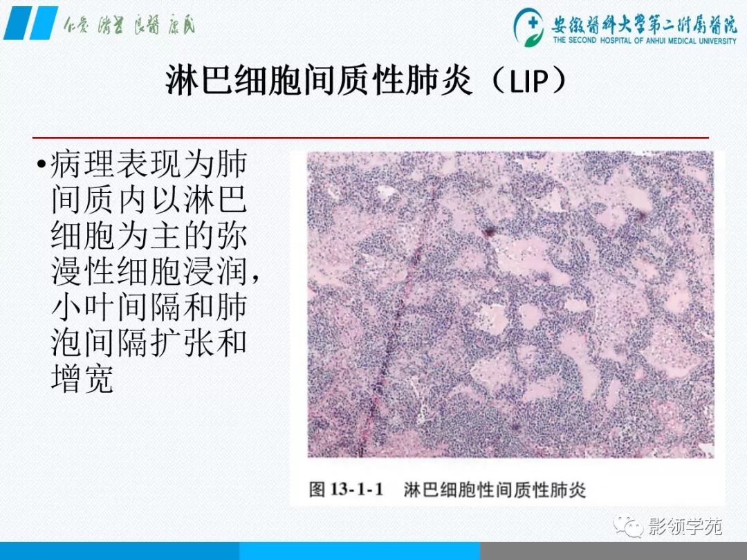 影像PPT - 【PPT】间质性肺炎病理及影像认识-18 影像PPT - 【PPT】间质性肺炎病理及影像认识-18