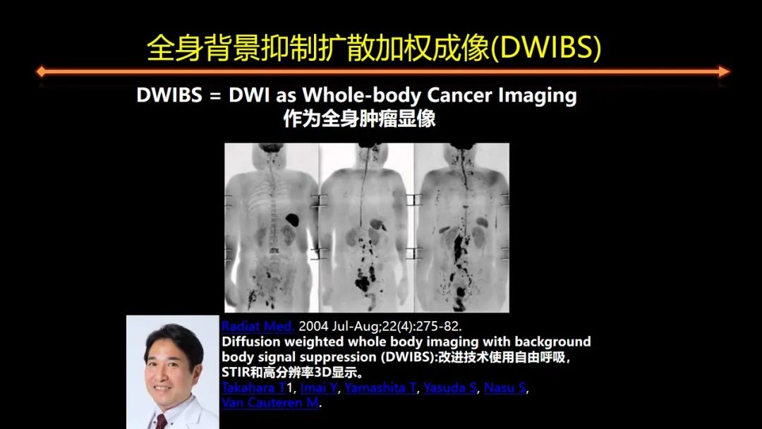 影像PPT - 【PPT】女性致密型乳腺的MR平扫筛查-22