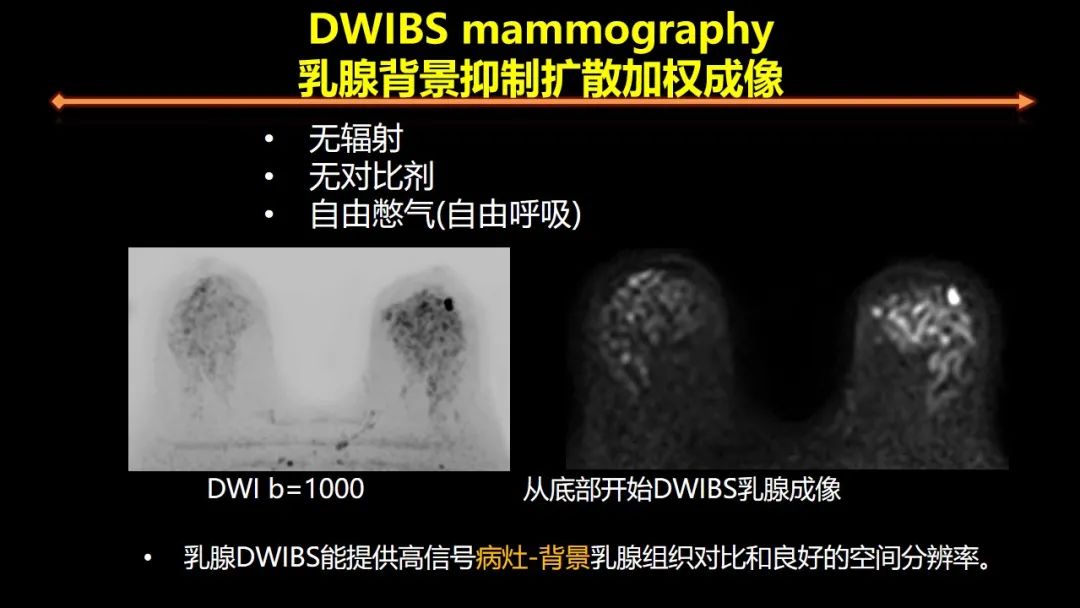 影像PPT - 【PPT】女性致密型乳腺的MR平扫筛查-28