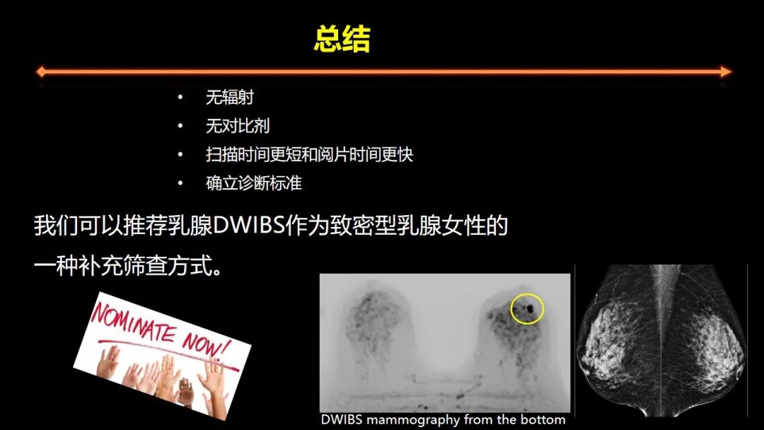 影像PPT - 【PPT】女性致密型乳腺的MR平扫筛查-66