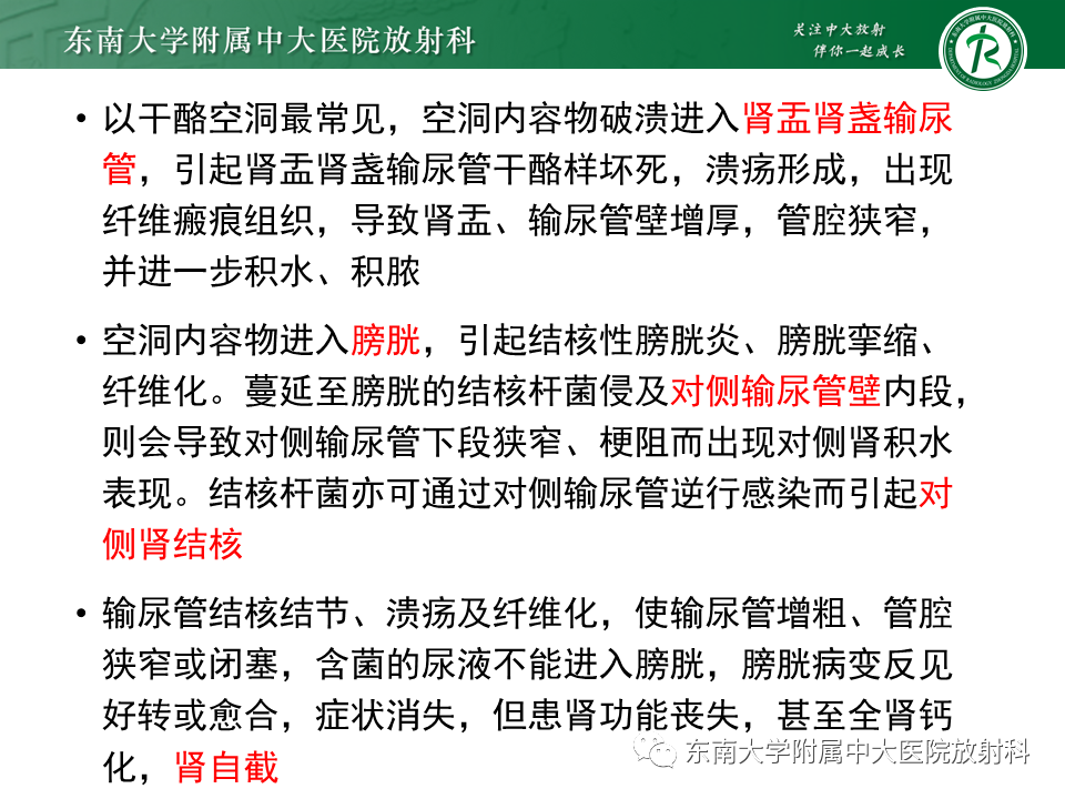 影像PPT - 【PPT】肾结核的影像诊断-10