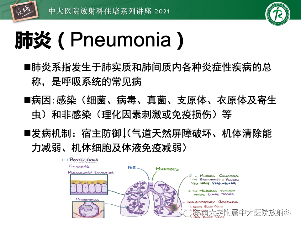 影像PPT - 【PPT】常见细菌性肺炎与病毒性肺炎的鉴别诊断（以COVID-19为例）-3