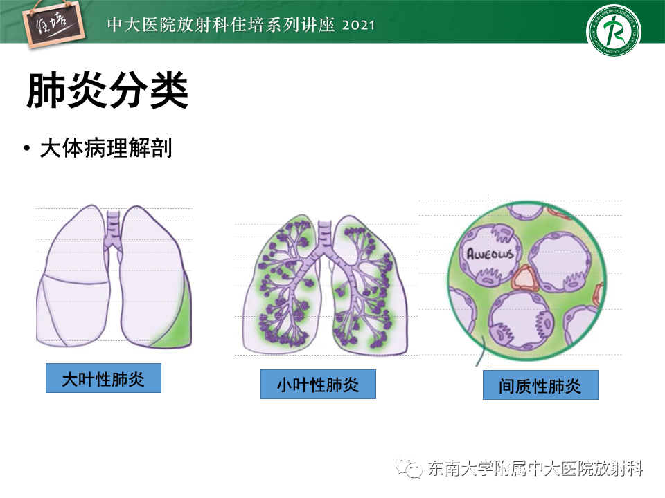 影像PPT - 【PPT】常见细菌性肺炎与病毒性肺炎的鉴别诊断（以COVID-19为例）-5