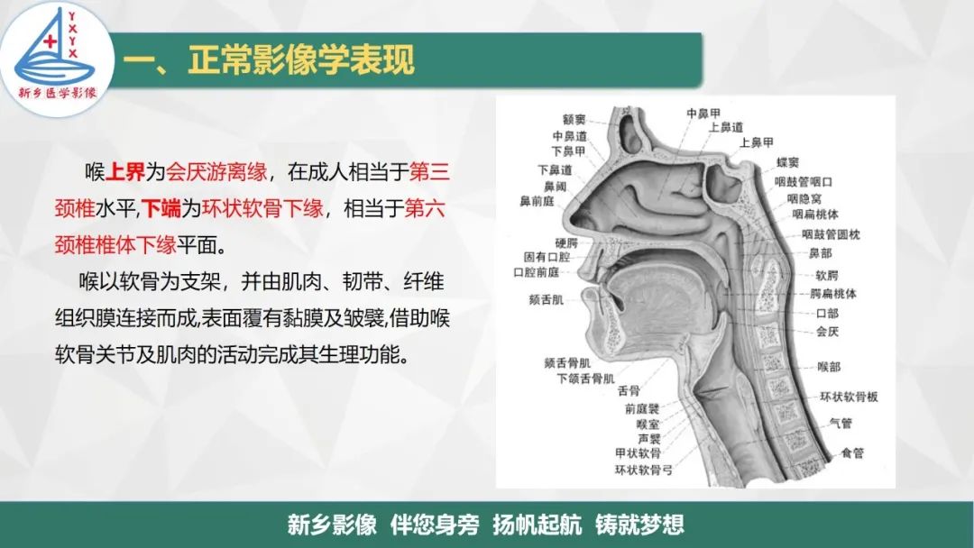 影像PPT - 【PPT】医学影像诊断学教材解读—喉部疾病-3