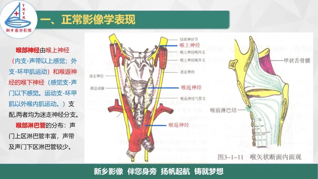 影像PPT - 【PPT】医学影像诊断学教材解读—喉部疾病-6