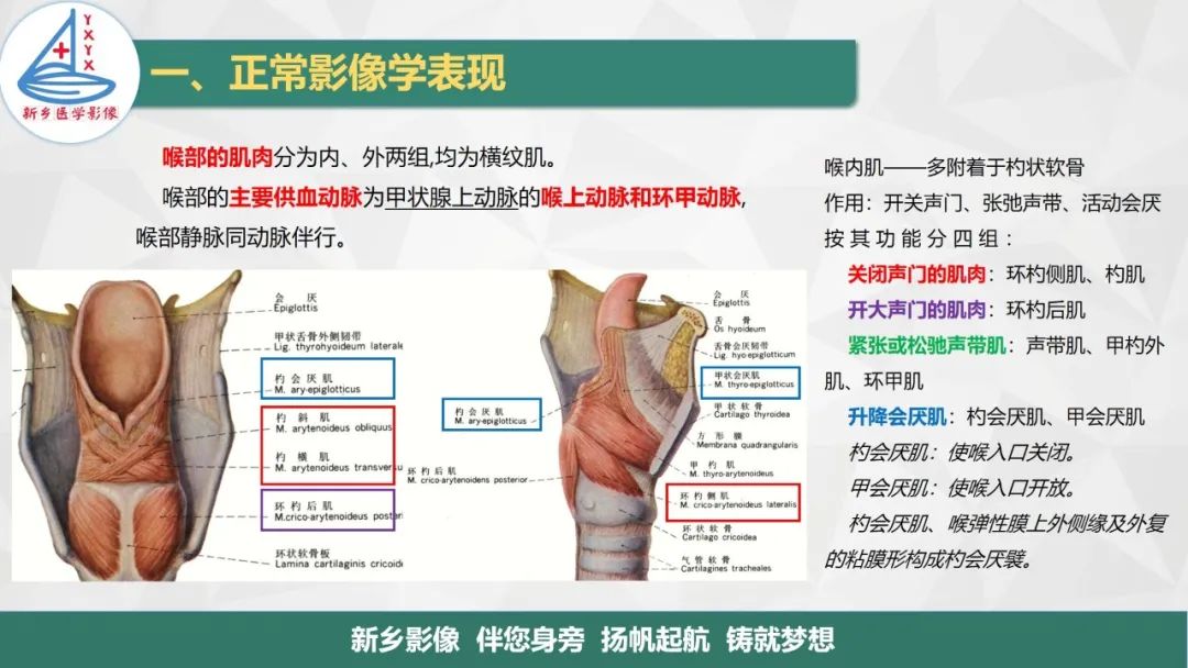 影像PPT - 【PPT】医学影像诊断学教材解读—喉部疾病-5