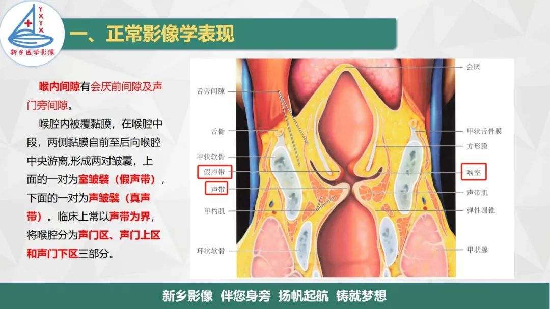 影像PPT - 【PPT】医学影像诊断学教材解读—喉部疾病-7