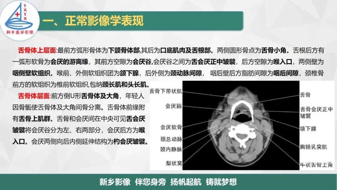 影像PPT - 【PPT】医学影像诊断学教材解读—喉部疾病-8