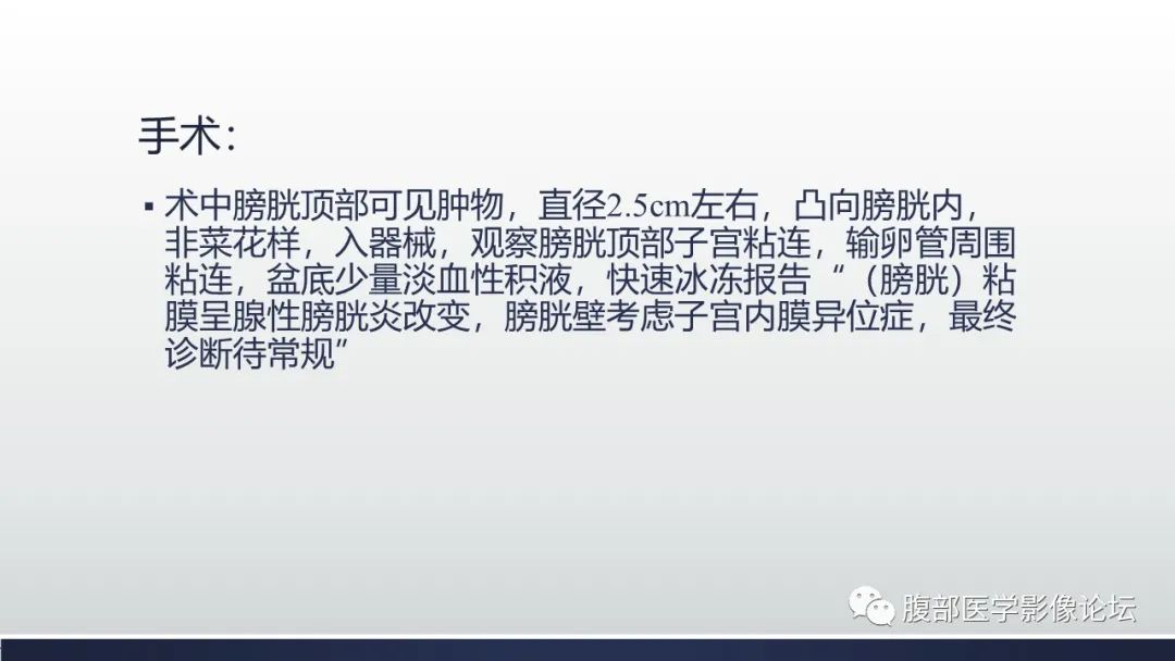 影像PPT - 【病例】膀胱子宫内膜异位症伴腺性膀胱炎1例CT影像-10