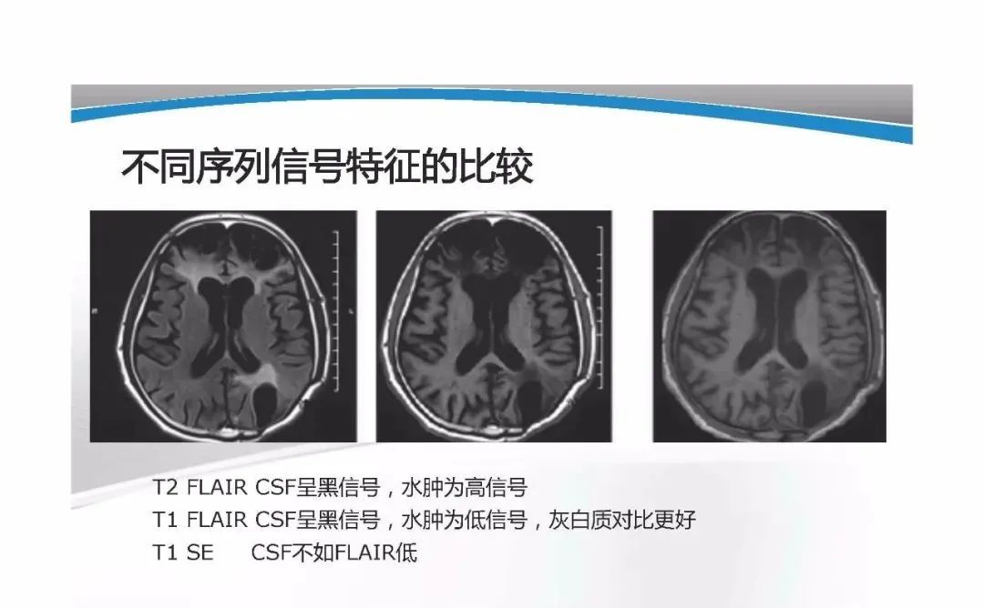 影像PPT - 【PPT】T1WI信号分析与颅内病变图像判读-7