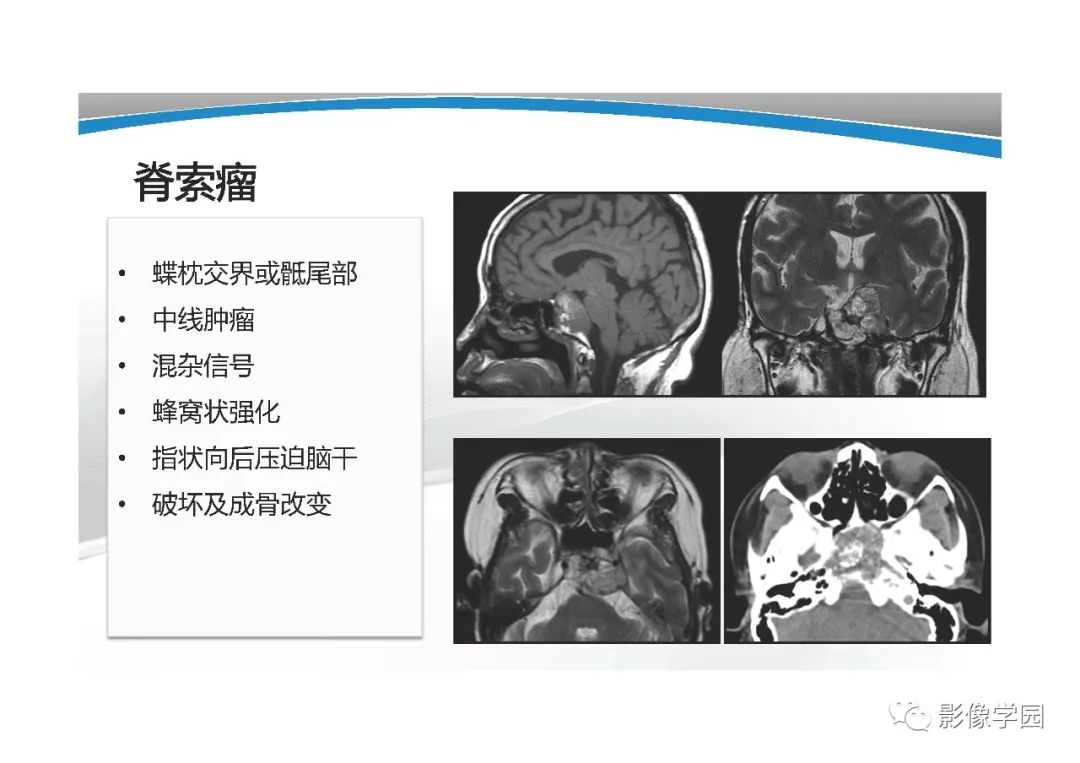 影像PPT - 【PPT】T1WI信号分析与颅内病变图像判读-12