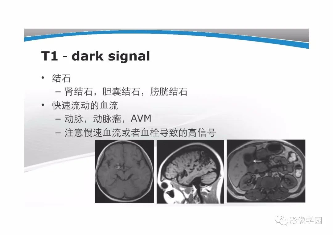 影像PPT - 【PPT】T1WI信号分析与颅内病变图像判读-14