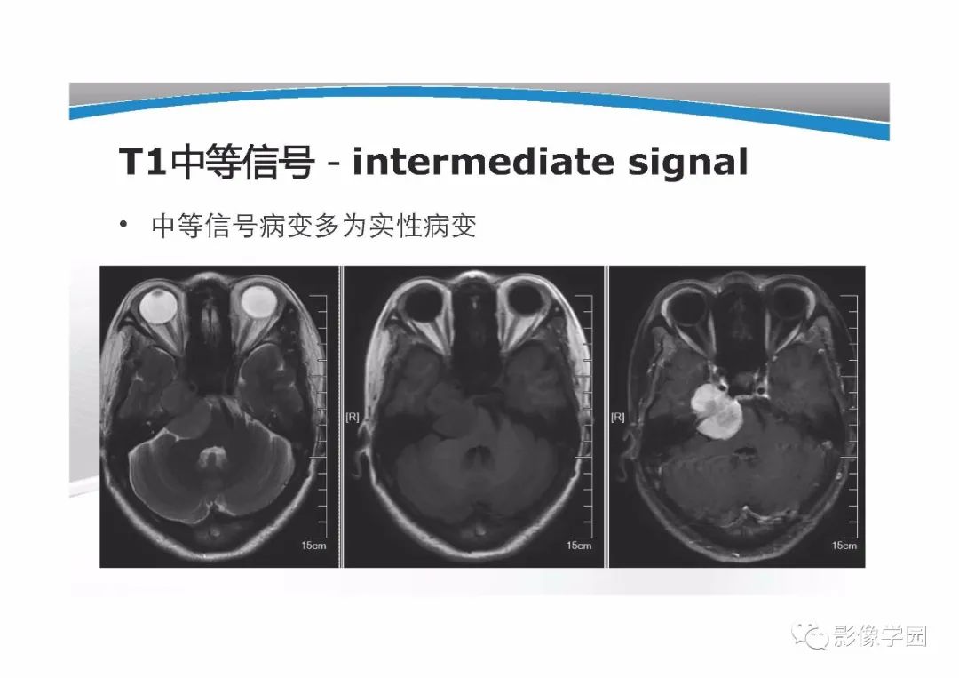影像PPT - 【PPT】T1WI信号分析与颅内病变图像判读-19