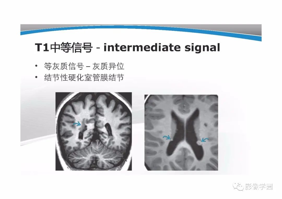 影像PPT - 【PPT】T1WI信号分析与颅内病变图像判读-21
