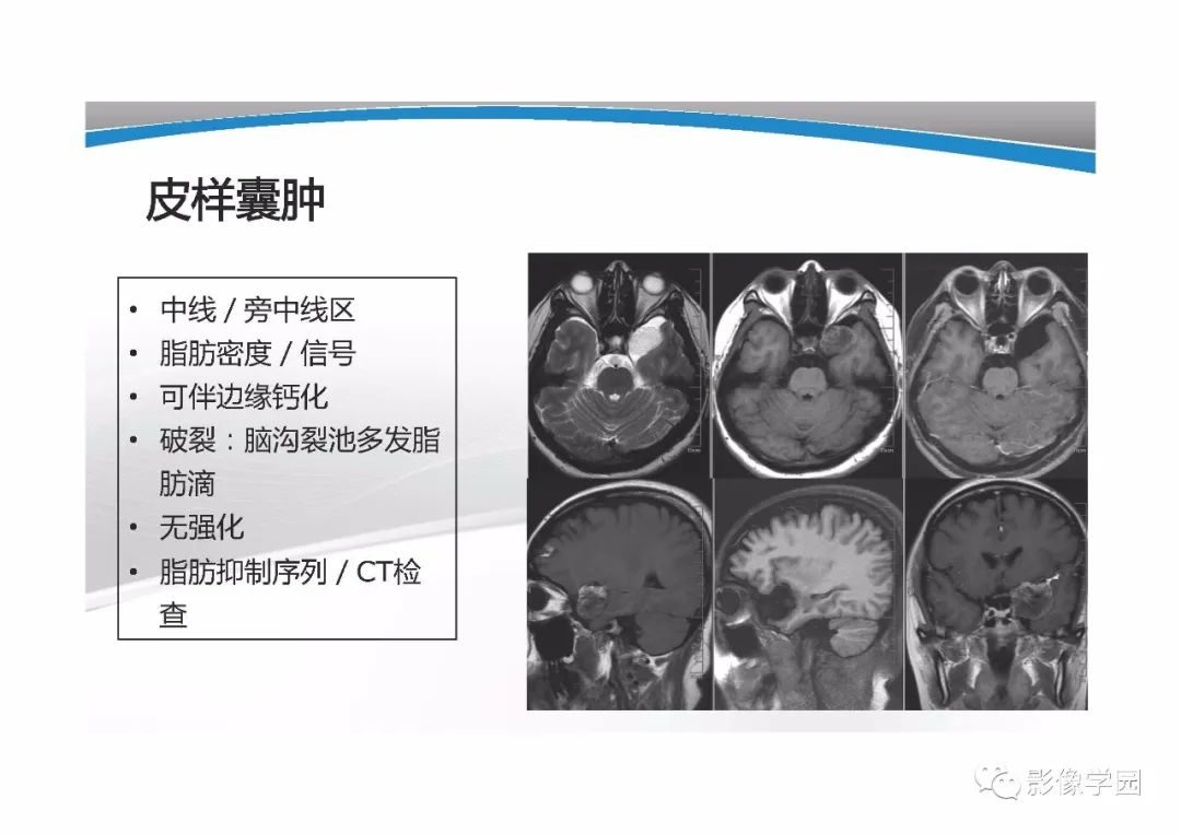 影像PPT - 【PPT】T1WI信号分析与颅内病变图像判读-31