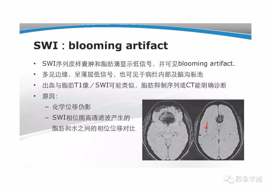 影像PPT - 【PPT】T1WI信号分析与颅内病变图像判读-34