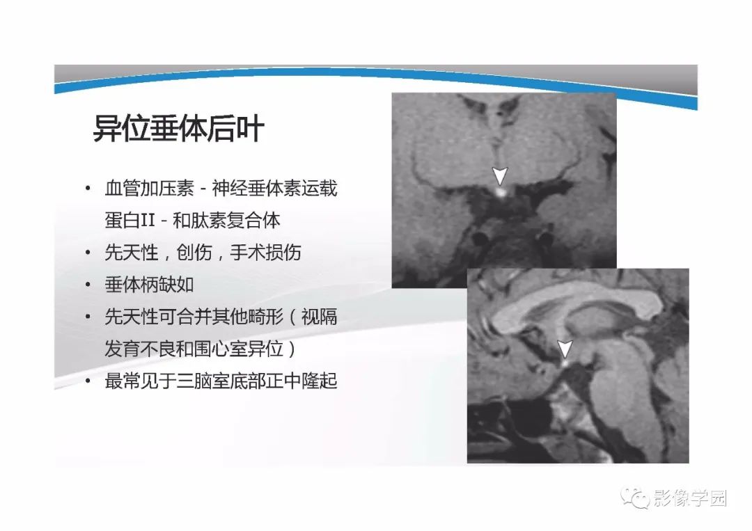 影像PPT - 【PPT】T1WI信号分析与颅内病变图像判读-40