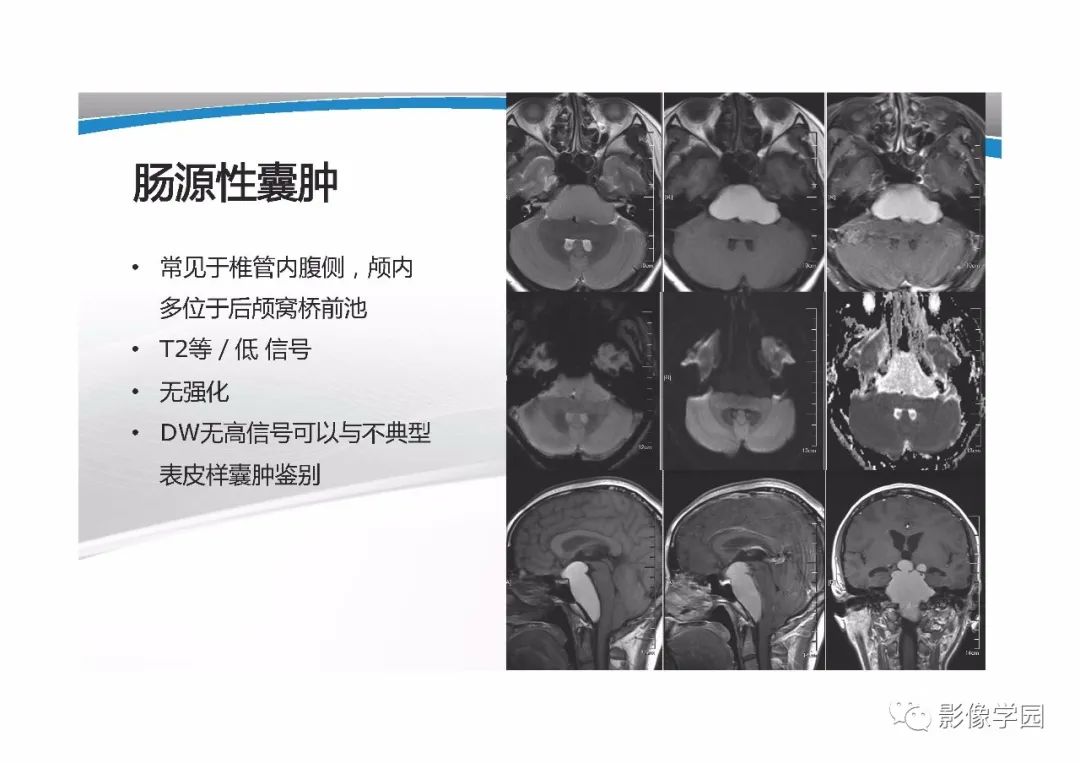 影像PPT - 【PPT】T1WI信号分析与颅内病变图像判读-41