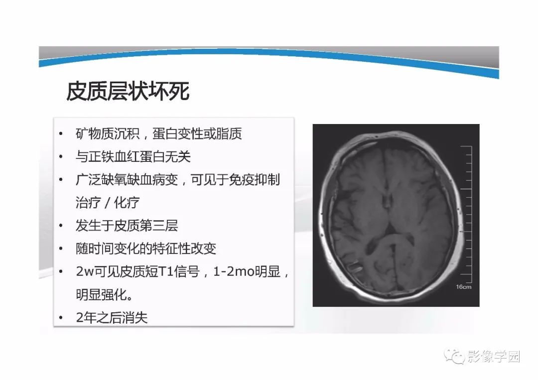 影像PPT - 【PPT】T1WI信号分析与颅内病变图像判读-48