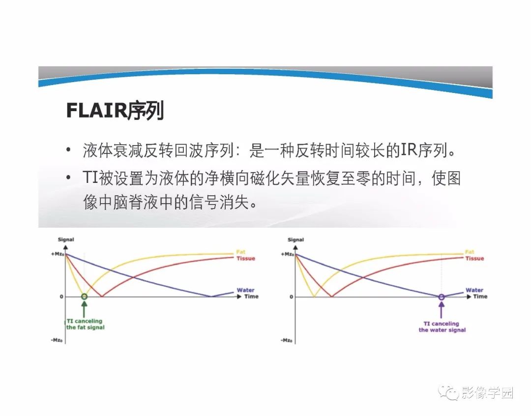 影像PPT - 【PPT】T1WI信号分析与颅内病变图像判读-57
