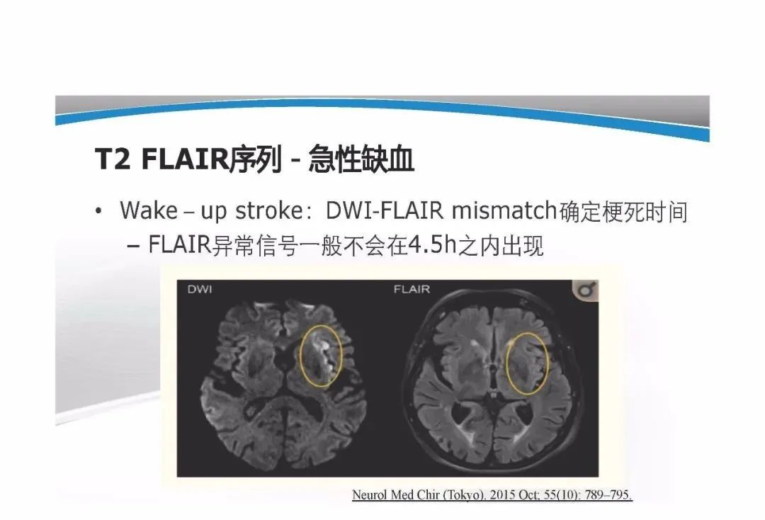 影像PPT - 【PPT】T1WI信号分析与颅内病变图像判读-68