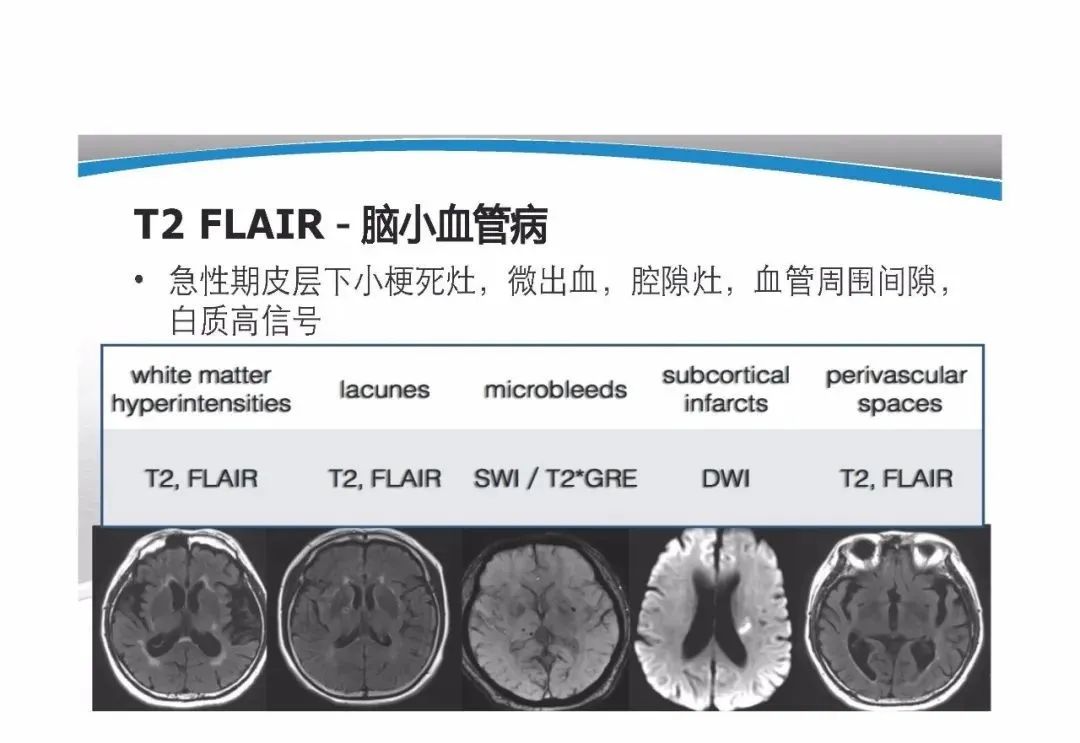 影像PPT - 【PPT】T1WI信号分析与颅内病变图像判读-70