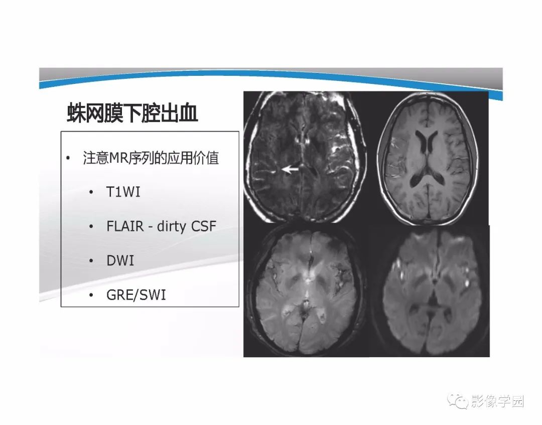 影像PPT - 【PPT】T1WI信号分析与颅内病变图像判读-81