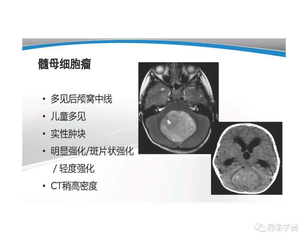 影像PPT - 【PPT】T1WI信号分析与颅内病变图像判读-89