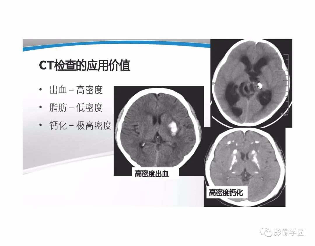 影像PPT - 【PPT】T1WI信号分析与颅内病变图像判读-98