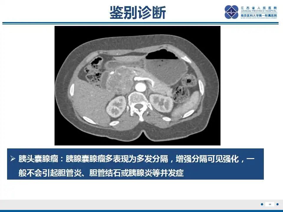 影像PPT - 【PPT】十二指肠乳头旁憩室综合征-29