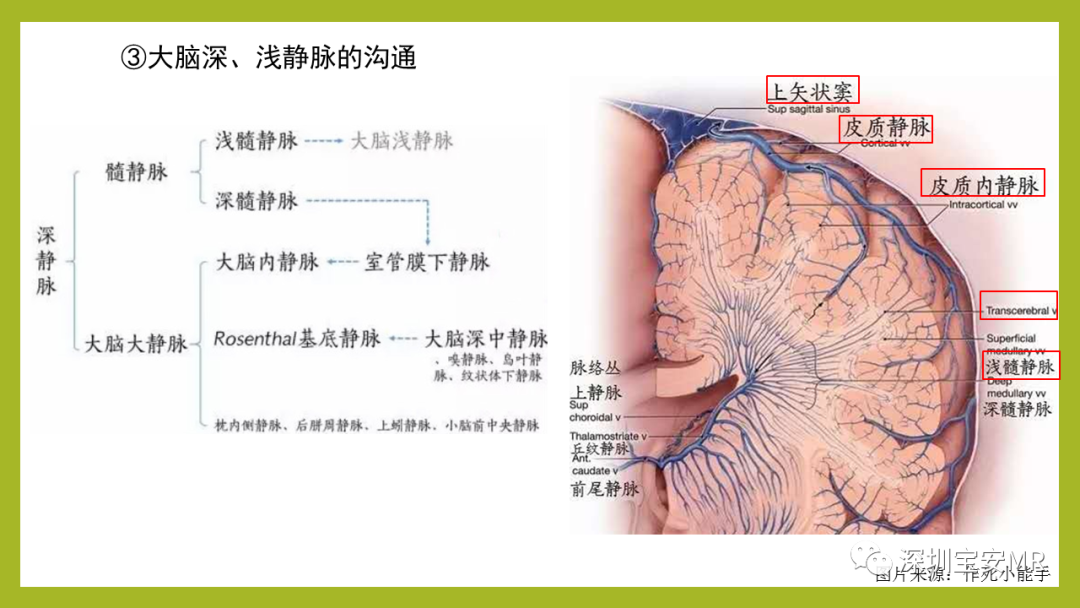 影像PPT - 【PPT】Sturge-Weber 综合征-6