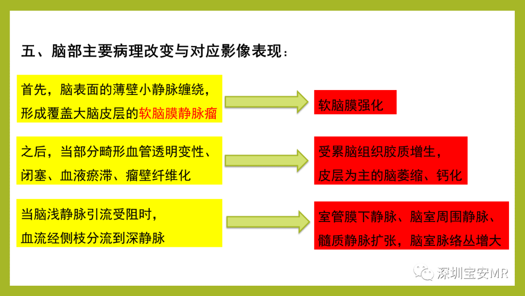 影像PPT - 【PPT】Sturge-Weber 综合征-7