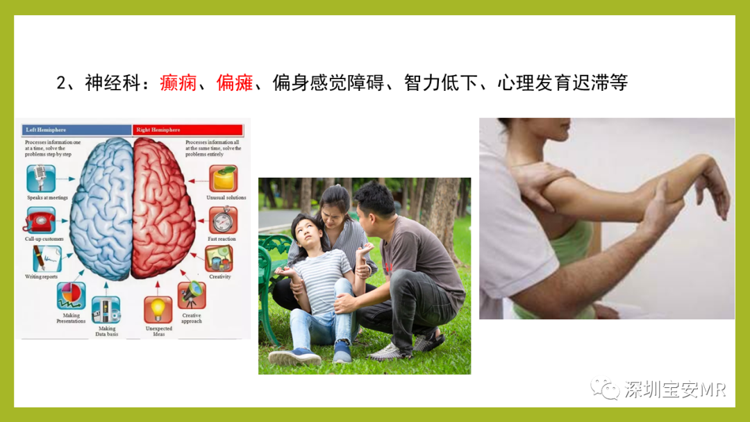 影像PPT - 【PPT】Sturge-Weber 综合征-18