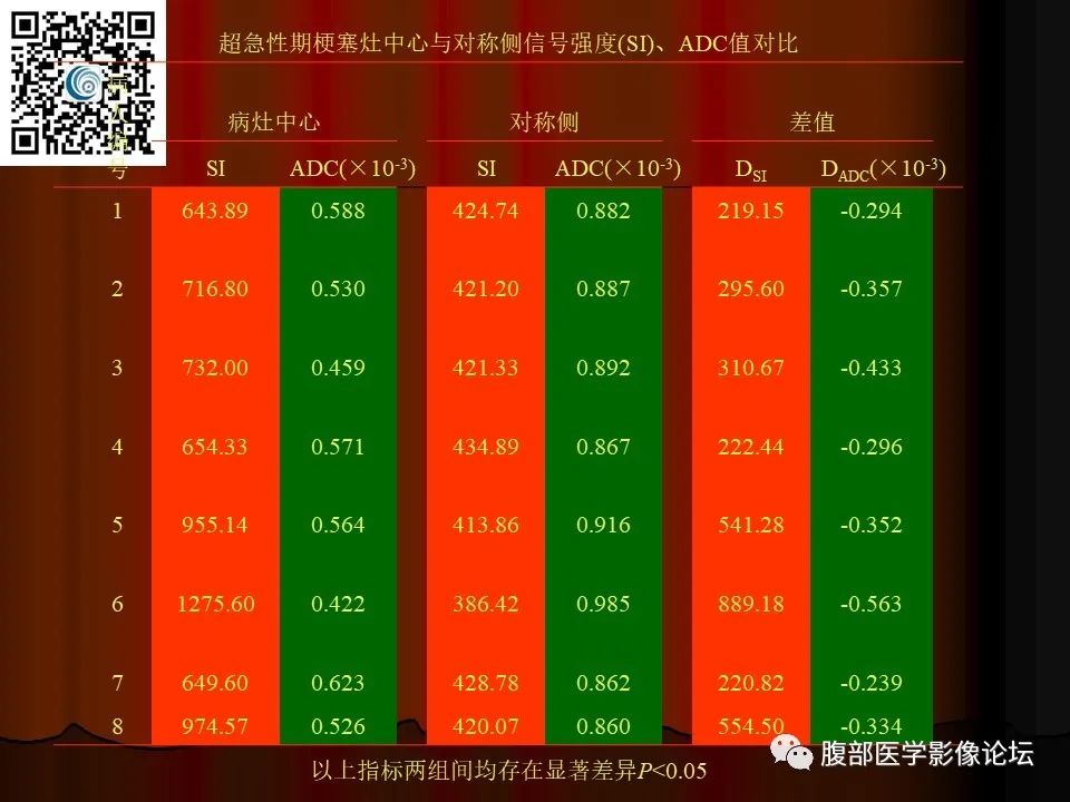 影像PPT - 【PPT】基于DWI的公式法对脑梗死病情进展的评估作用-25