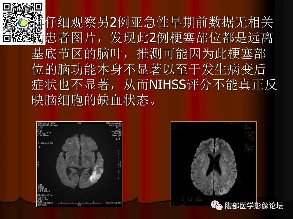 影像PPT - 【PPT】基于DWI的公式法对脑梗死病情进展的评估作用-79