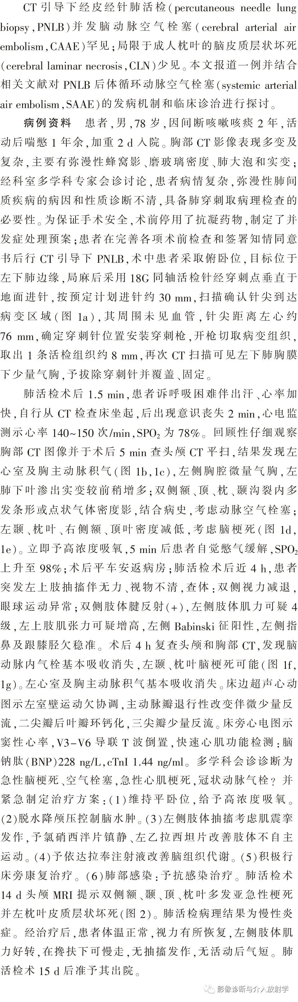 影像PPT - 【病例】经皮肺活检并发空气栓塞致脑皮质层状坏死一例CT及MR-2 影像PPT - 【病例】经皮肺活检并发空气栓塞致脑皮质层状坏死一例CT及MR-2
