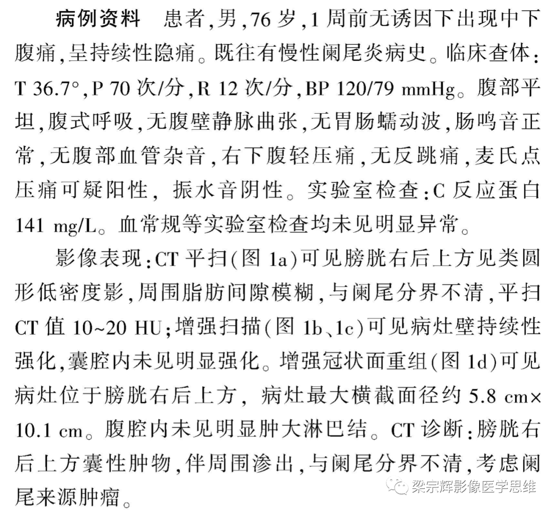 影像PPT - 【病例】阑尾良性肿瘤1例CT影像诊断思维-3
