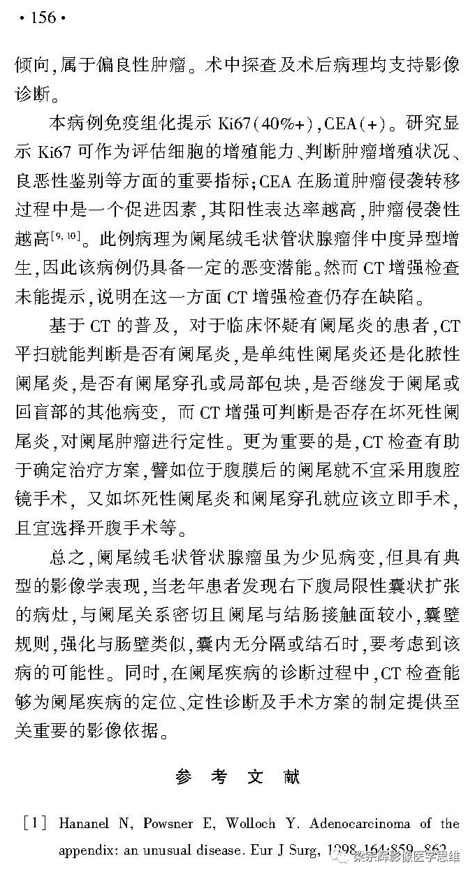 影像PPT - 【病例】阑尾良性肿瘤1例CT影像诊断思维-9