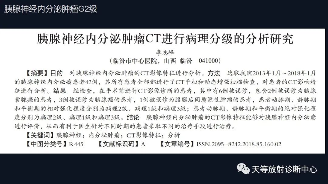 影像PPT - 【病例】胰腺神经内分泌肿瘤G2级1例CT及MR影像-19 影像PPT - 【病例】胰腺神经内分泌肿瘤G2级1例CT及MR影像-19