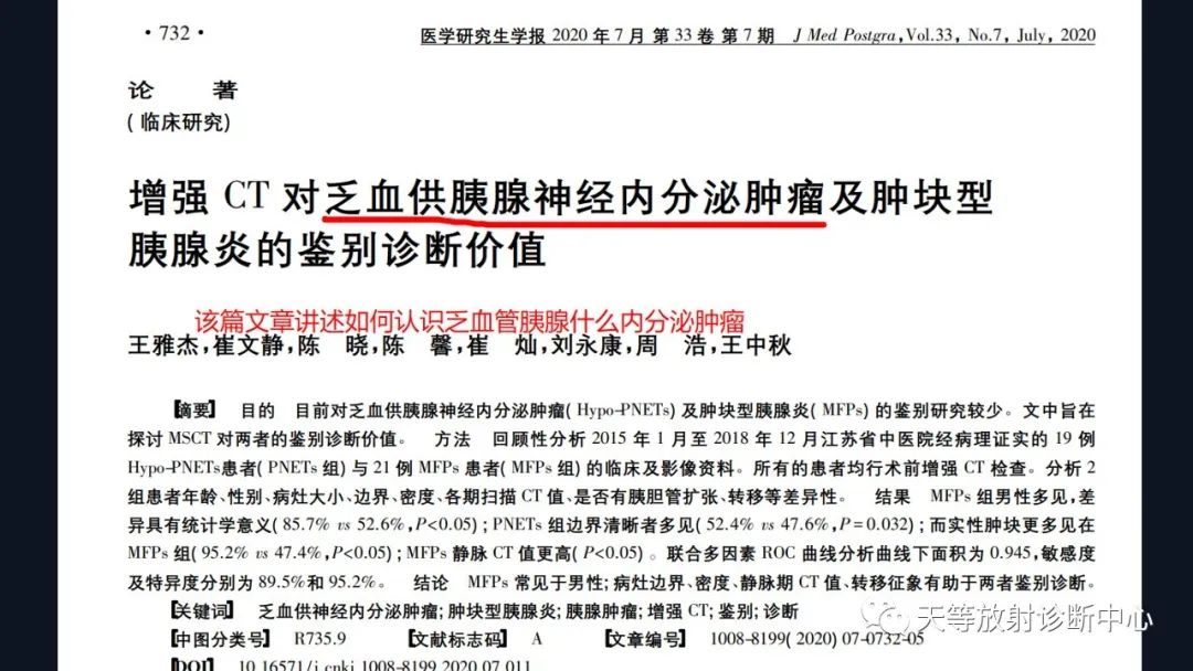 影像PPT - 【病例】胰腺神经内分泌肿瘤G2级1例CT及MR影像-21 影像PPT - 【病例】胰腺神经内分泌肿瘤G2级1例CT及MR影像-21