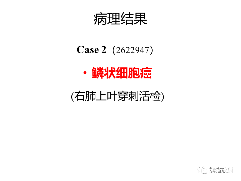 影像PPT - 【病例】肺肌上皮癌 VS 鳞状细胞癌CT影像-22