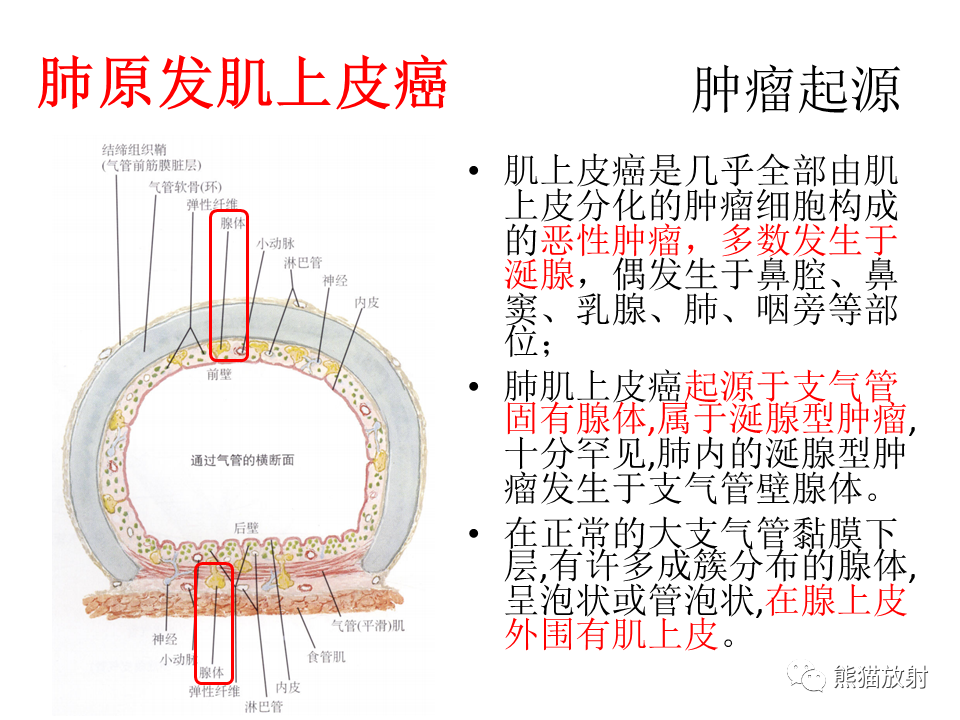 影像PPT - 【病例】肺肌上皮癌 VS 鳞状细胞癌CT影像-23