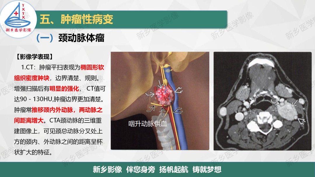 影像PPT - 【PPT】医学影像诊断学教材解读—颈部疾病-11