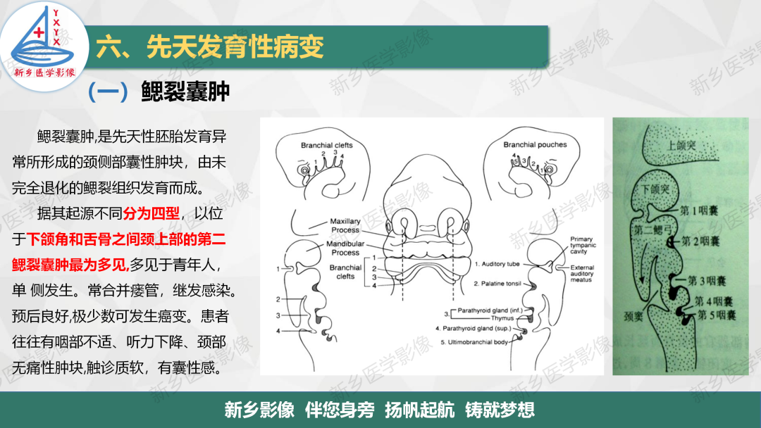影像PPT - 【PPT】医学影像诊断学教材解读—颈部疾病-27