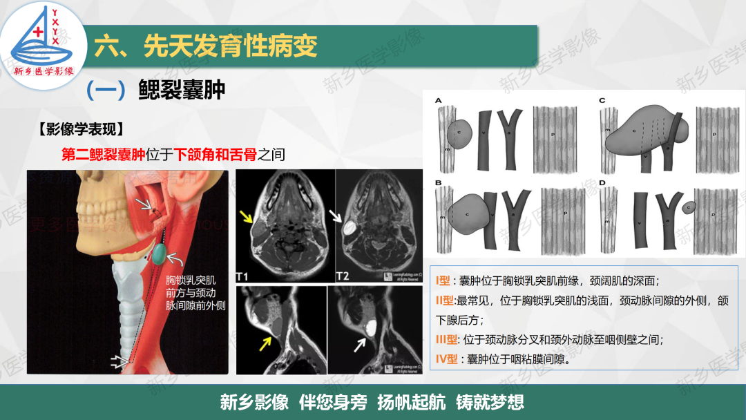 影像PPT - 【PPT】医学影像诊断学教材解读—颈部疾病-29