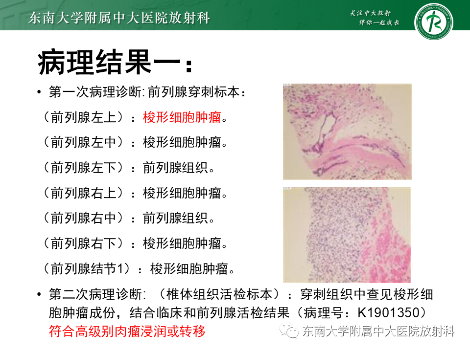 影像PPT - 【病例】前列腺病例随访讨论3例MR-5 影像PPT - 【病例】前列腺病例随访讨论3例MR-5